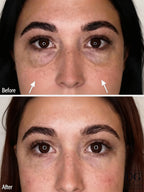 Tensorix Ojeras, Bolsas y Líneas
