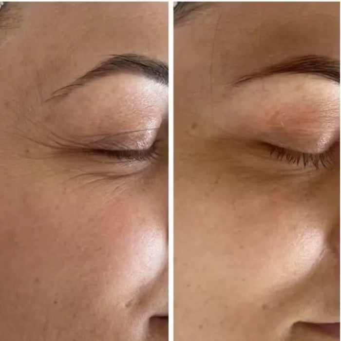 Tensorix Ojeras, Bolsas y Líneas