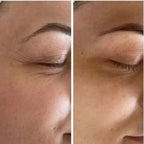 Tensorix Ojeras, Bolsas y Líneas