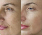 Tensorix Ojeras, Bolsas y Líneas