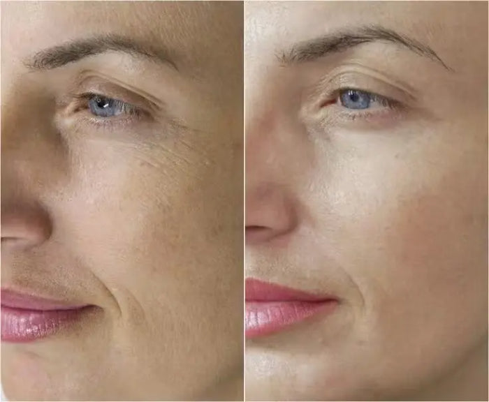 Tensorix Ojeras, Bolsas y Líneas