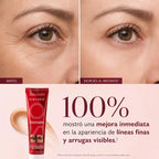 Tensorix Ojeras, Bolsas y Líneas