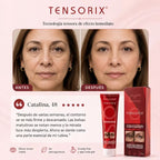 Tensorix Ojeras, Bolsas y Líneas